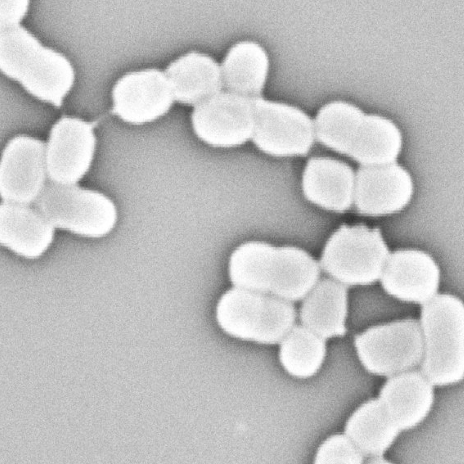 モラクセラ菌の顕微鏡写真|いつもの洗濯で、部屋干し臭・黄ばみ・カビ対策できる「洗濯機用オゾン水生成器」|ELEZONE(エレゾン)